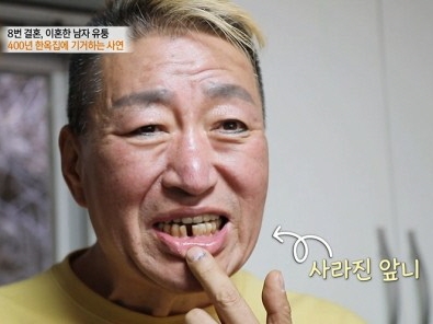 【画像】バツ8・前妻は33歳下モンゴル女性・事業失敗・糖尿病で歯は抜ける…60代韓国俳優のイマ