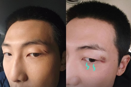 RM