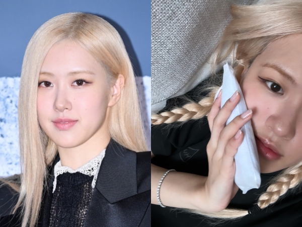 「痛そう…」BLACKPINK・ロゼ、親知らずを抜いて腫れ上がった頬を公開【PHOTO】