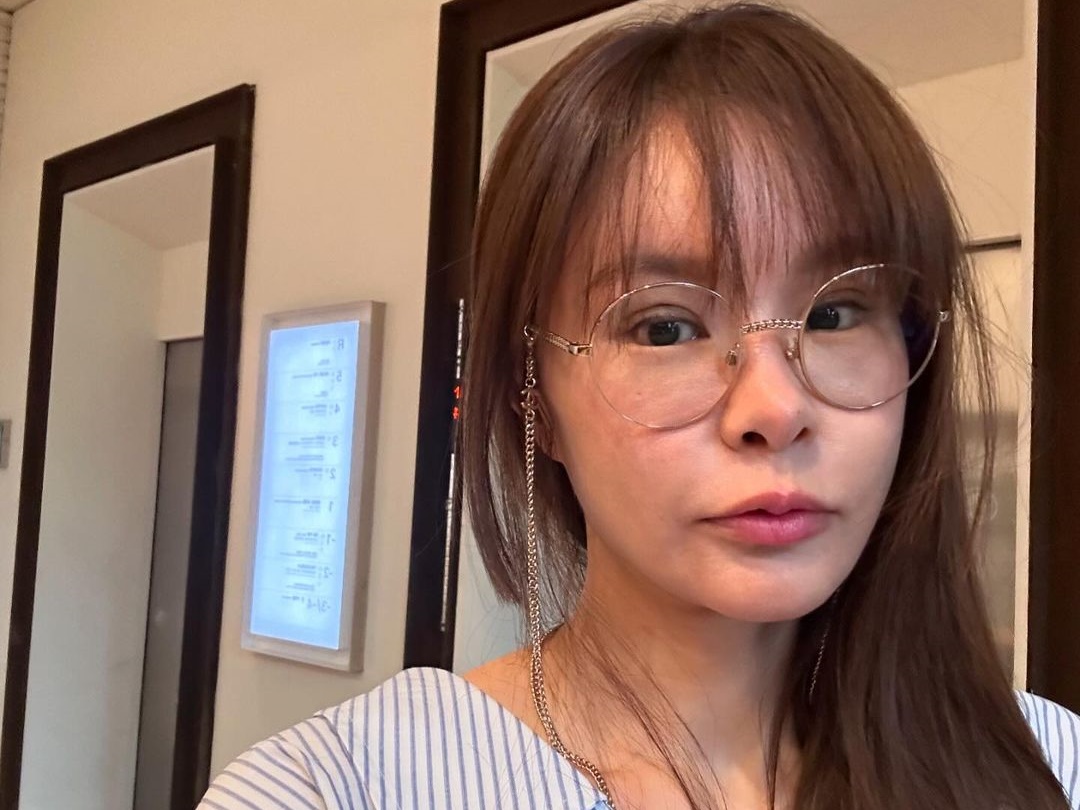 「とても自然！」“整形手術”から48時間後の姿、韓国人気モノマネ芸人の妻が近況公開【PHOTO】