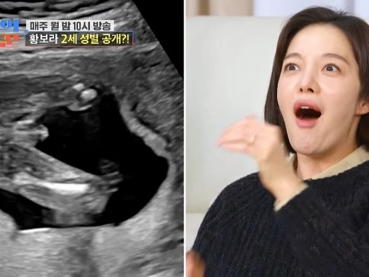 ハ・ジョンウの弟と結婚した『キム秘書』出演女優、お腹の子の性別が判明！「義実家には息子しか…」
