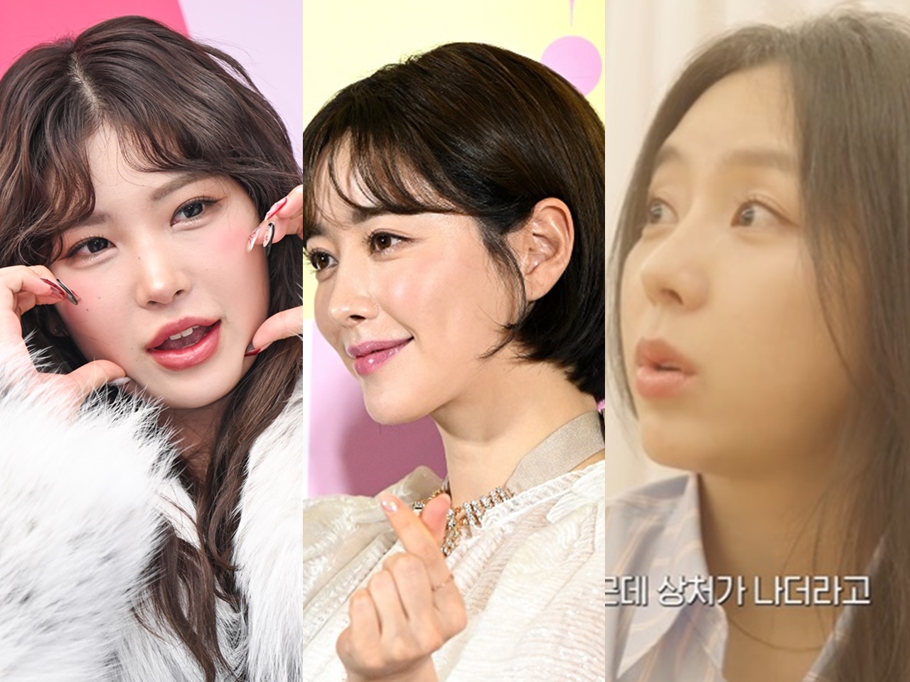「鼻先を少し上げた」と整形手術を明かす元K-POPアイドル…“顔は全部”から“胸の手術”まで告白する韓国スターたち