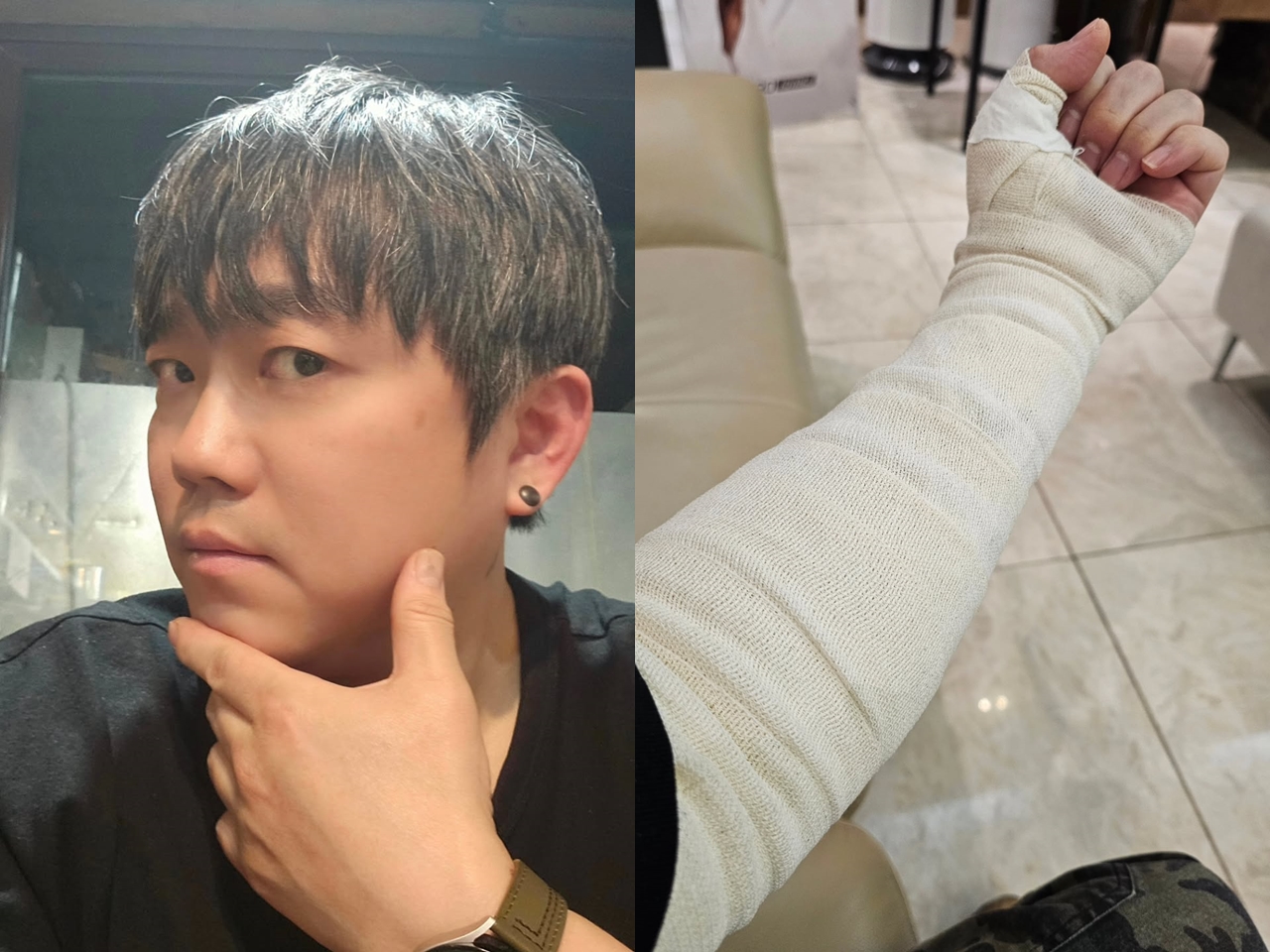 「自分の体に残っていた芸能人病の痕跡」タトゥー除去を開始した韓国歌手、“きれいな体で生きていく”と宣言