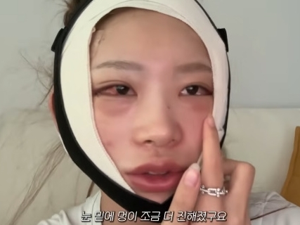 まるで“顔面フルリフォーム”…急逝した元巨人投手・国民的女優が両親　韓国インフルエンサーが大規模整形